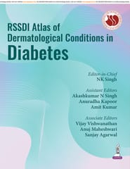 Rssdi Atlas Of Dermatological Conditions In Diabetes 1st Edition 2026 By Nk Singh