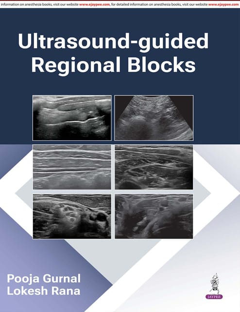 Ultrasound-Guided Regional Blocks 1st Edition 2026 By Pooja Gurnal