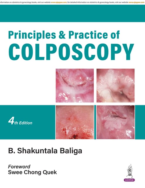 Principles And Practice Of Colposcopy 4th Edition 2026 By B Shakuntala Baliga
