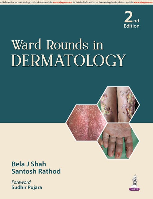 Ward Rounds In Dermatology 2nd Edition 2026 By Bela J Shah