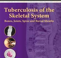 Tuberculosis Of The Skeletal System 7th Edition 2026 By Sm Tuli