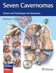 Seven Carvernomas Tenets and Techniquis for Resection 1st Edition  2025 By Lawton