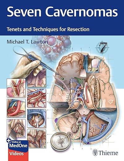 Seven Carvernomas Tenets and Techniquis for Resection 1st Edition  2025 By Lawton
