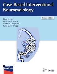 Case-Based Interventional Neuroradiology 2nd Ed. 2025 By Krings