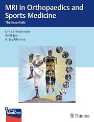 MRI in Orthopaedics and Sports Medicine : The Essentials 1st Edition  2025 By Srikumaran
