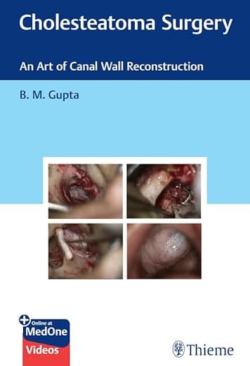 Cholesteatoma Surgery An Art of Canal Wall Reconstruction 1st Edition  2025 By Gupta
