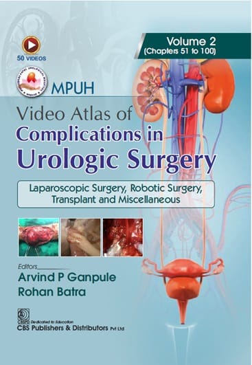 MPUH Video Atlas of Complications in Urologic Surgery, Volume 2 1st Edition 2026 By Arvind P Ganpule