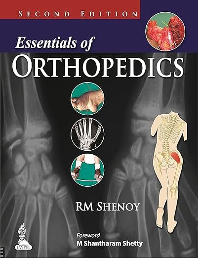 Essentials of Orthopedics 2nd Reprint Edition 2026 By Rm Shenoy