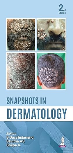 Snapshots In Dermatology 2nd Edition 2026 By S Sacchidanand