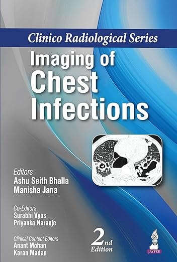 Clinico Radiological Series Imaging of Chest Infections 2nd Edition 2026 By Ashu Seith Bhalla