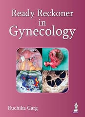 Ready Reckoner In Gynecology 1st Edition 2026 By Ruchika Garg