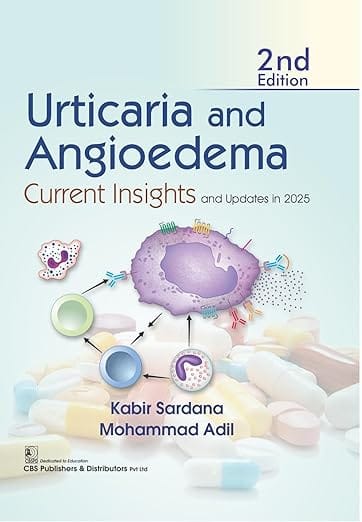 Urticaria And Angioedema Current Insights And Updates In 2025 2nd Edition 2026 By Kabir Sardana