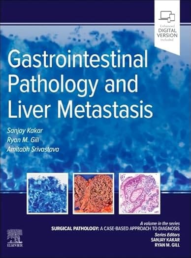 Gastrointestinal Pathology And Liver Metastasis A Case Based Approach To Diagnosis 2025 By Kakar S.