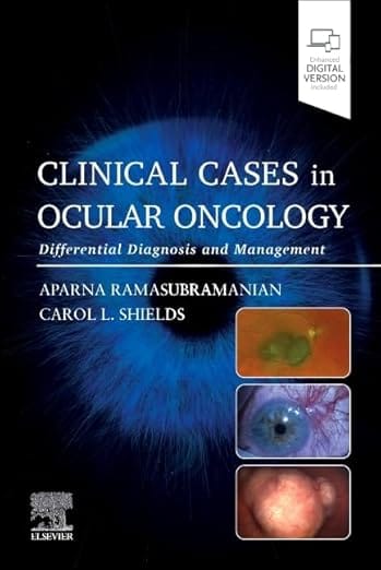 Clinical Cases In Ocular Oncology Differential Diagnosis And Management With Access Code 2025 By Ramasubramanian A.