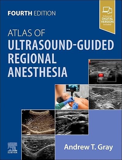 Atlas of Ultrasound Guided Regional Anesthesia With Access Code 4th Edition 2026 By Gray A T