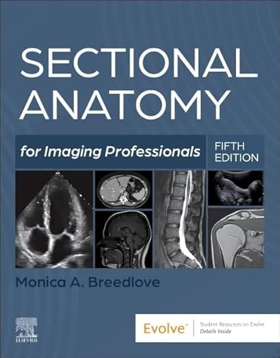 Sectional Anatomy For Imaging Professionals With Access Code 5th Edition 2025 By Breedlove M