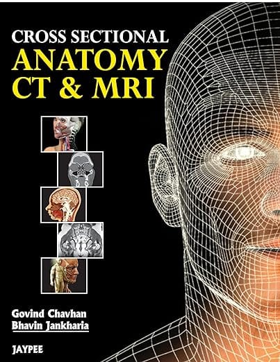 Cross Sectional Anatomy Ct And Mri 1st Edition Reprint 2026 By Govind B Chavhan