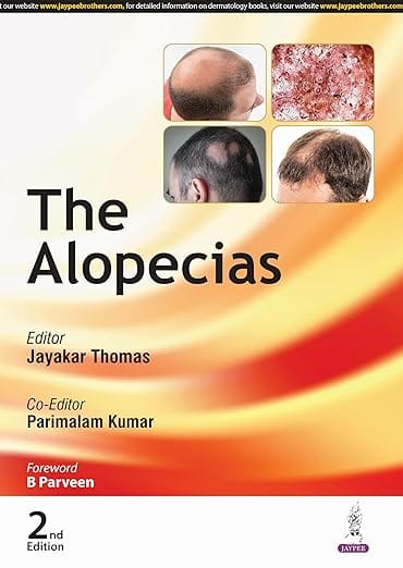 The Alopecias 2nd Edition Reprint 2026 By Jayakar Thomas