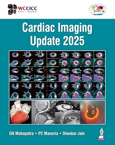 Cardiac Imaging Update 2025 1st Edition 2026 By Gn Mahapatra