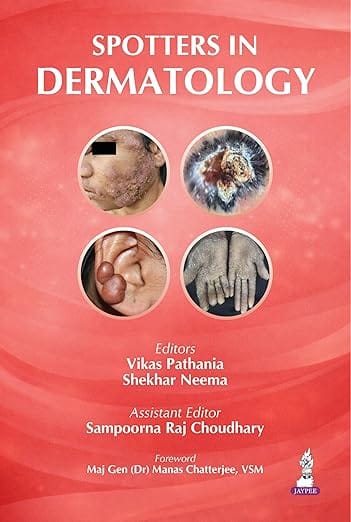 Spotters In Dermatology 1st Edition 2026 By Vikas Pathania