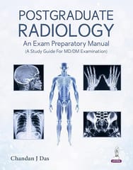 Postgraduate Radiology An Exam Preparatory Manual 1st Edition 2026 By Chandan Das