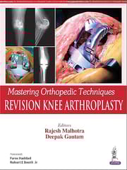 Mastering Orthopedic Techniques Revision Knee Arthroplasty 1st Edition Reprint 2025 By Rajesh Malhotra