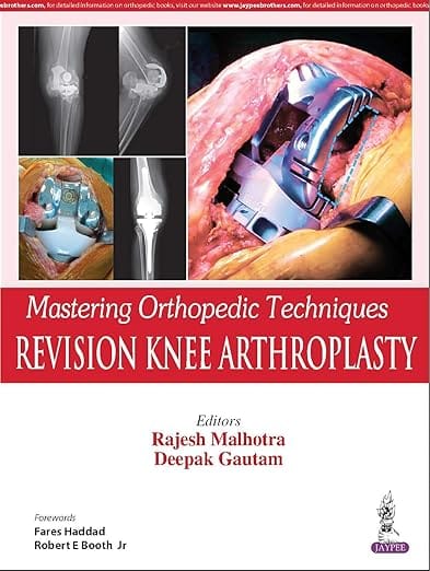 Mastering Orthopedic Techniques Revision Knee Arthroplasty 1st Edition Reprint 2025 By Rajesh Malhotra