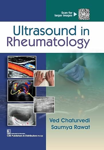 Ultrasound In Rheumatology 2026 By Ved Chaturvedi