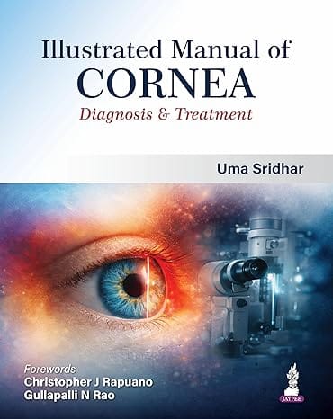 Illustrated Manual Of Cornea Diagnosis & Treatment 1st Edition 2026 By Uma Sridhar