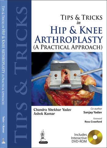 Tips & Tricks In Hip & Knee Arthroplasty (A Practical Approach) 1st Reprint Edition 2026 By Shekhar Yadav Chandra