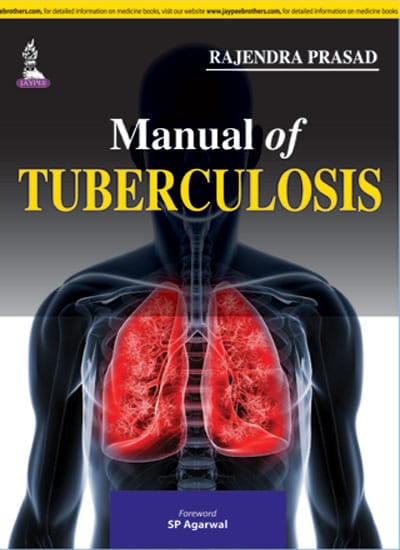 Manual of Tuberculosis 1st Reprint Edition 2026 By Rajendra Prasad
