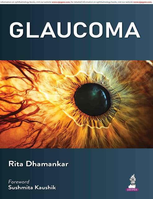 Glaucoma 1st Edition 2026 By Rita Dhamankar