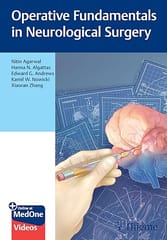 Operative Fundamentals In Neurological Surgery  2026 By Agarwal N