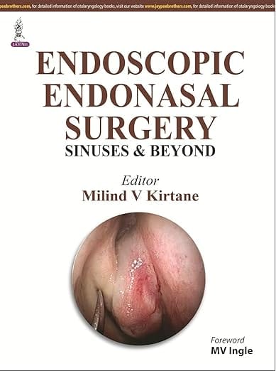 Endoscopic Endonasal Surgery Sinuses & Beyond 1st Reprint Edition 2026 By Milind V Kirtane