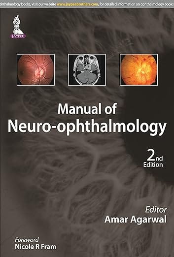 Manual Of Neuro-Ophthalmology 2nd Reprint Edition 2026 By Amar Agarwal