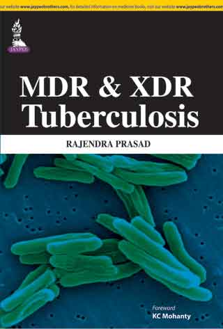 Mdr & Xdr Tuberculosis 1st Reprint Edition 2026 By Rajendra Prasad