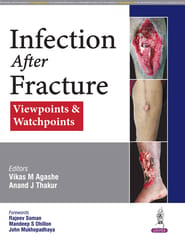 Infection After Fracture : Viewpoints & Watchpoints 1st Edition 2026 By Vikas M Agashe