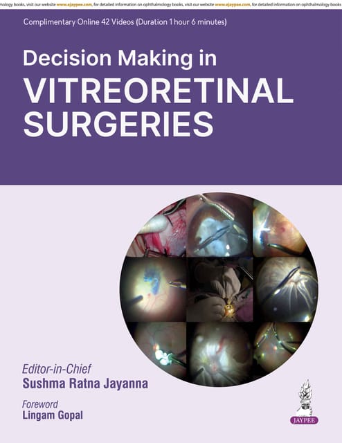 Decision Making In Vitreoretinal Surgeries 1st Edition 2026 By Sushma Ratna Jayanna