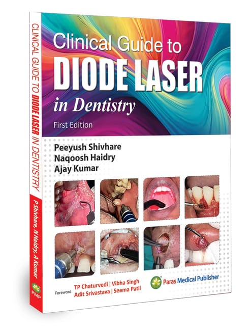 Clinical Guide to Diode Laser in Dentistry 1st Edition 2026 By Peeyush Shivhare