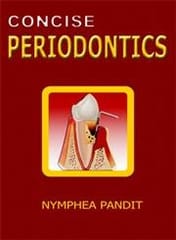 Concise Periodontics 1st edition 2008 By Nymphea