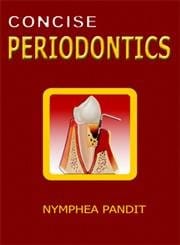 Concise Periodontics 1st edition 2008 By Nymphea