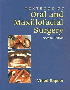 Textbook Of Oral And Maxillofacial Surgery 2nd edition 2015 By Kapoor