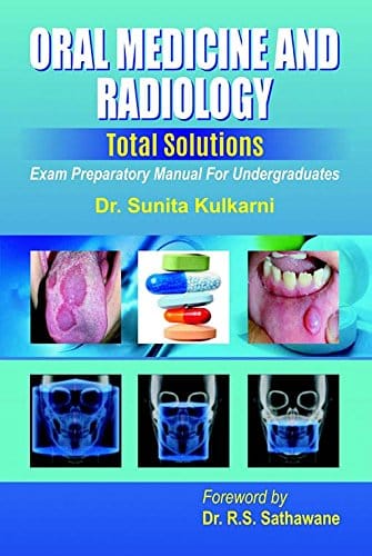 Oral Medicine & Radiology, Total Solutions 1st edition 2018 By Kulkarni