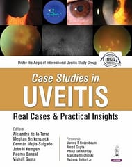 Case Studies In Uveitis : Real Cases And Practical Insights 1st Edition 2026 By Alejandra De-La-Torre