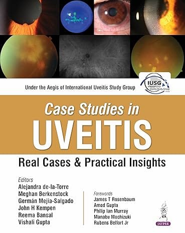 Case Studies In Uveitis : Real Cases And Practical Insights 1st Edition 2026 By Alejandra De-La-Torre