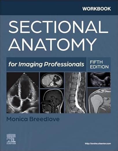 Workbook for Sectional Anatomy for Imaging Professionals  5th Edition 2025 By Breedlove