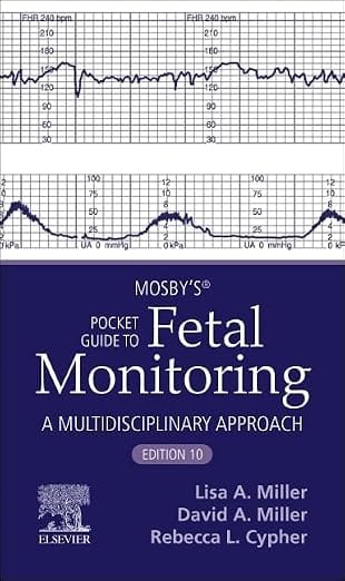 Mosbys Pocket Guide To Fetal Monitoring  10th Edition   2026 By Miller L A