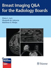Breast Imaging Q And A For The Radiology Boards  2026 By Lam D L