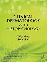 Clinical Dermatology With Histopathology  2027 By Shilpa Garg