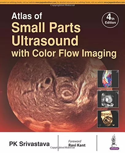 Atlas of Small Parts Ultrasound With Color Flow Imaging by PK Srivastava